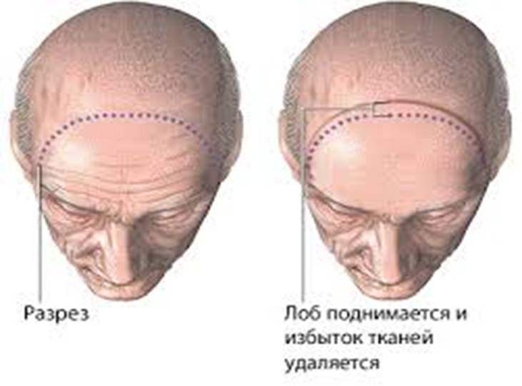 Лоб