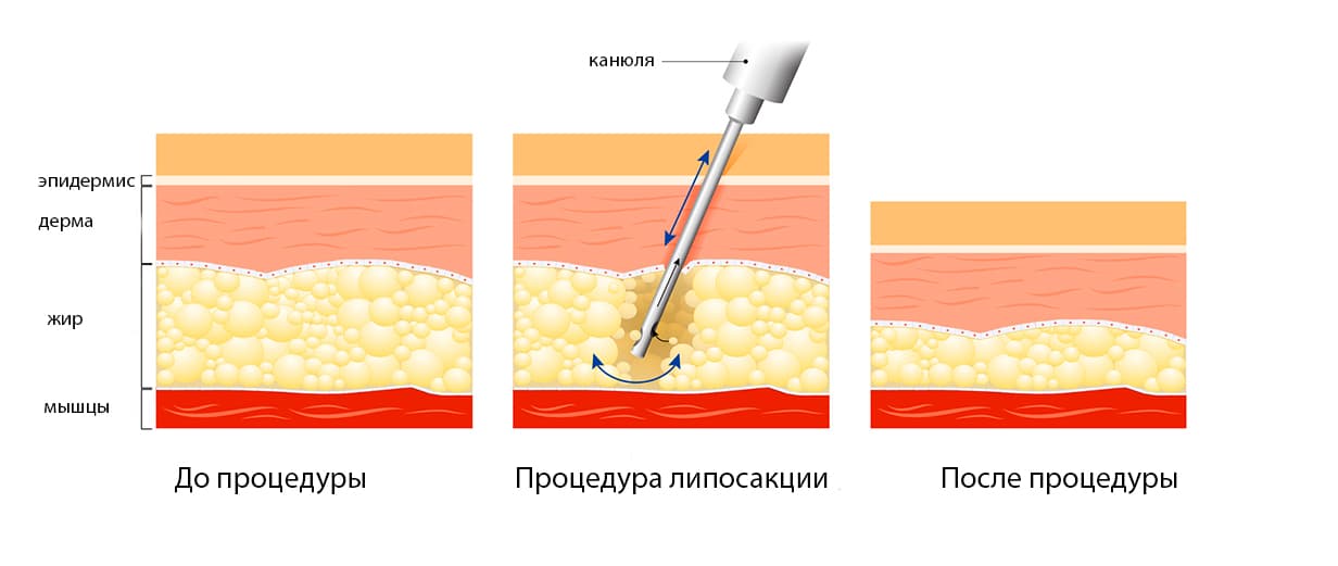 sdgwgret6354524.jpg - 39.68 kB