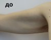 Брахиопластика - 5