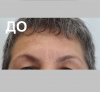 Лоб - 1