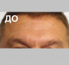 Лоб - 10