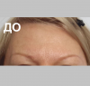 Лоб - 13