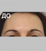 Лоб - 3
