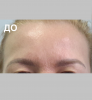 Лоб - 4