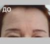 Лоб - 5