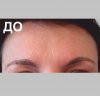 Лоб - 8