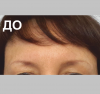 Лоб - 9