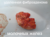 6rbehrhegw