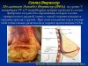 slide11
