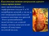 slide14